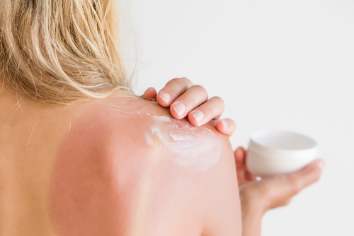 DIY huile après-soleil apaisante